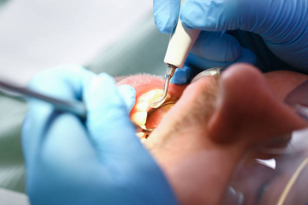 Best Emergency Care for Gum Disease in Fairland, MD