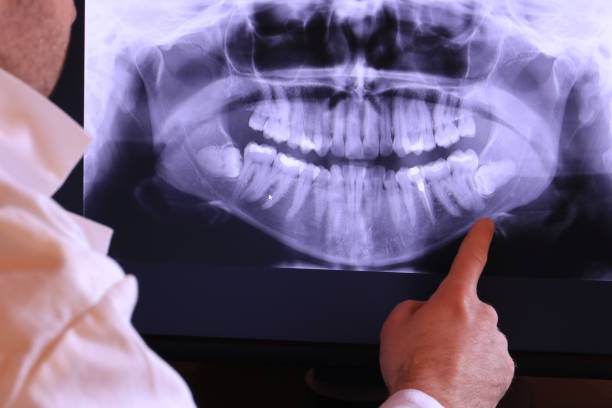 Best Dental Abscess Treatment in Fairland, MD