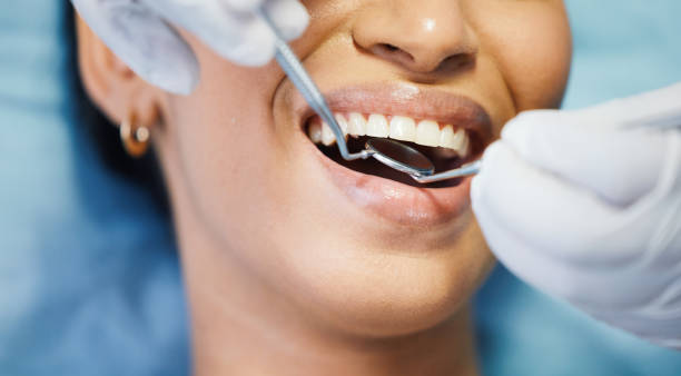Best Lost Filling or Crown Replacement in Fairland, MD